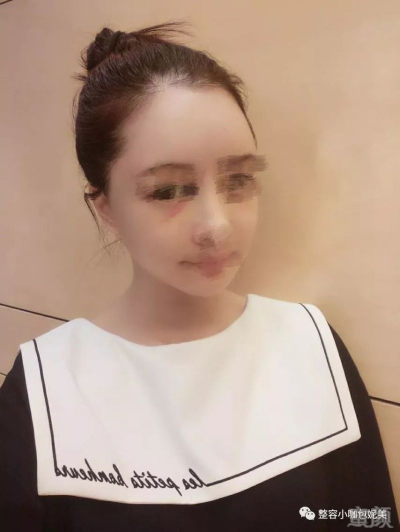 https://img.miyanlife.com/mnt/timg/180212/13554L252-6.jpg