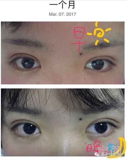 https://img.miyanlife.com/mnt/timg/180212/135G9DE-2.jpg