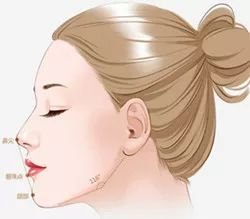 https://img.miyanlife.com/mnt/timg/180213/094U14N9-5.jpg