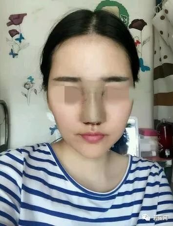 https://img.miyanlife.com/mnt/timg/180213/10194231L-3.jpg