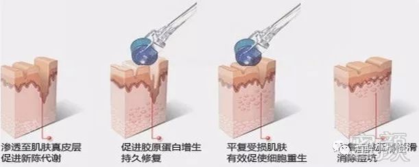 https://img.miyanlife.com/mnt/timg/180213/101I01564-2.jpg