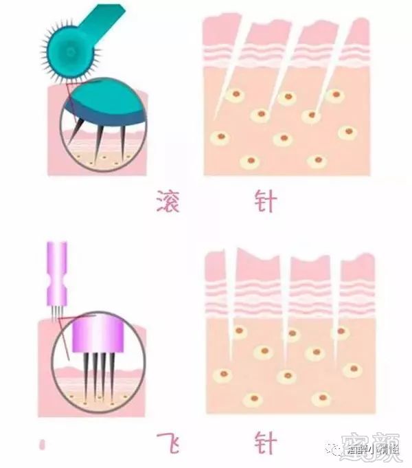 https://img.miyanlife.com/mnt/timg/180213/101I15553-3.jpg