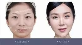 https://img.miyanlife.com/mnt/timg/180213/102Z32526-1.jpg