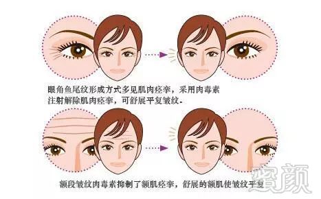https://img.miyanlife.com/mnt/timg/180213/103J9D61-4.jpg