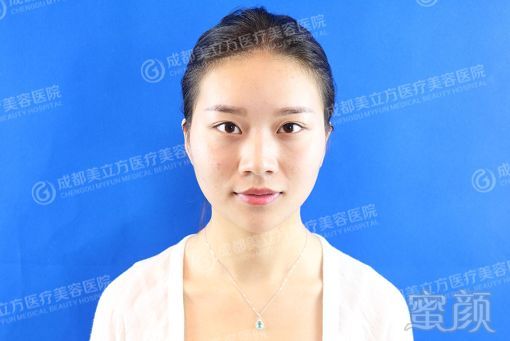 https://img.miyanlife.com/mnt/timg/180213/1045555G9-6.jpg