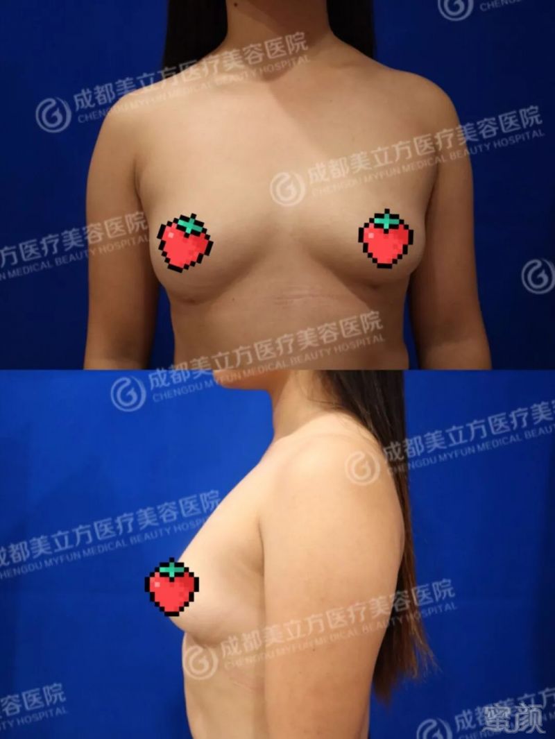 https://img.miyanlife.com/mnt/timg/180213/1045562L2-8.jpg