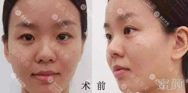 https://img.miyanlife.com/mnt/timg/180213/1241541447-3.jpg