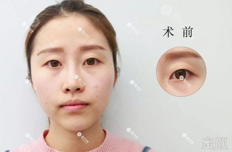 https://img.miyanlife.com/mnt/timg/180213/124155F56-6.jpg