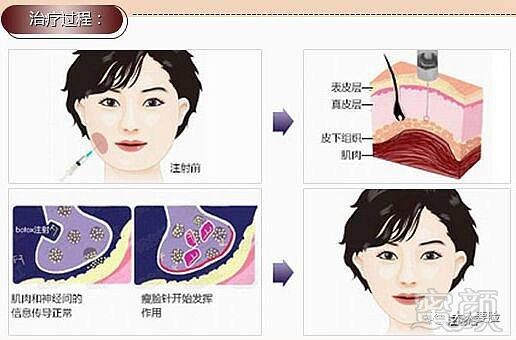 https://img.miyanlife.com/mnt/timg/180214/1022464134-11.jpg