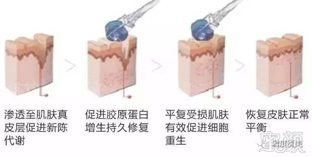 https://img.miyanlife.com/mnt/timg/180214/10364J047-9.jpg
