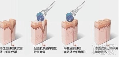 https://img.miyanlife.com/mnt/timg/180214/125A23L7-13.jpg