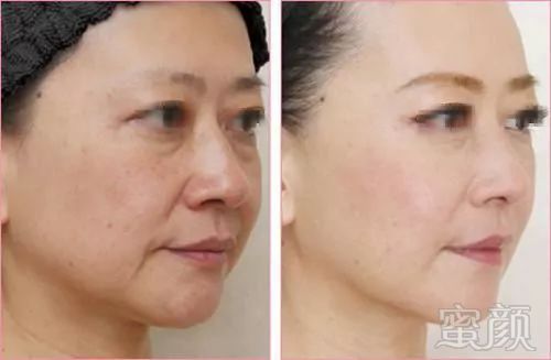 https://img.miyanlife.com/mnt/timg/180214/13033WZ6-4.jpg
