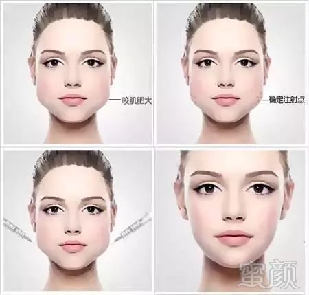 https://img.miyanlife.com/mnt/timg/180215/09522S293-3.jpg