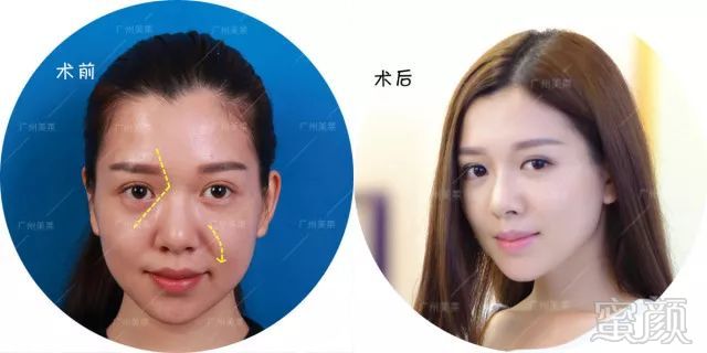 https://img.miyanlife.com/mnt/timg/180215/095H4MD-3.jpg