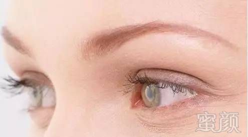 https://img.miyanlife.com/mnt/timg/180215/095SSD6-0.jpg