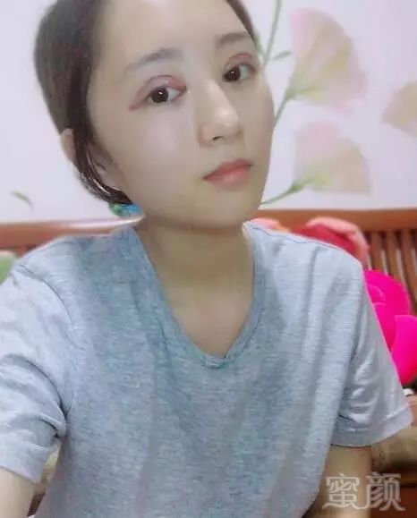 https://img.miyanlife.com/mnt/timg/180215/100122IN-2.jpg