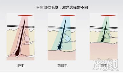 案例图片