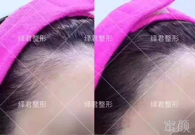 https://img.miyanlife.com/mnt/timg/180218/144S012T-4.jpg