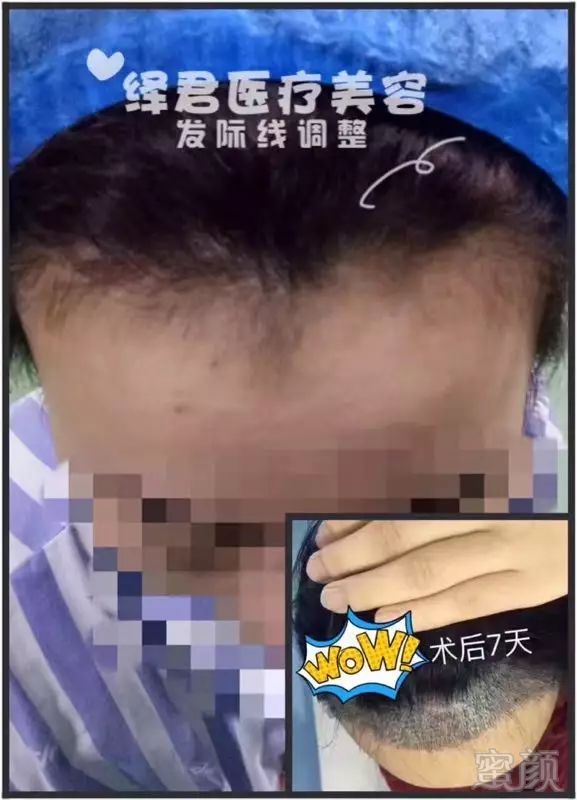 https://img.miyanlife.com/mnt/timg/180218/144S159A-5.jpg