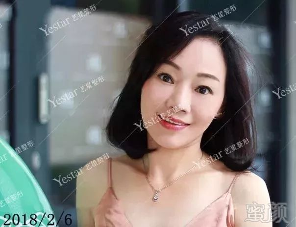 https://img.miyanlife.com/mnt/timg/180218/1451291942-1.jpg