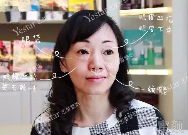 https://img.miyanlife.com/mnt/timg/180218/1451292451-2.jpg