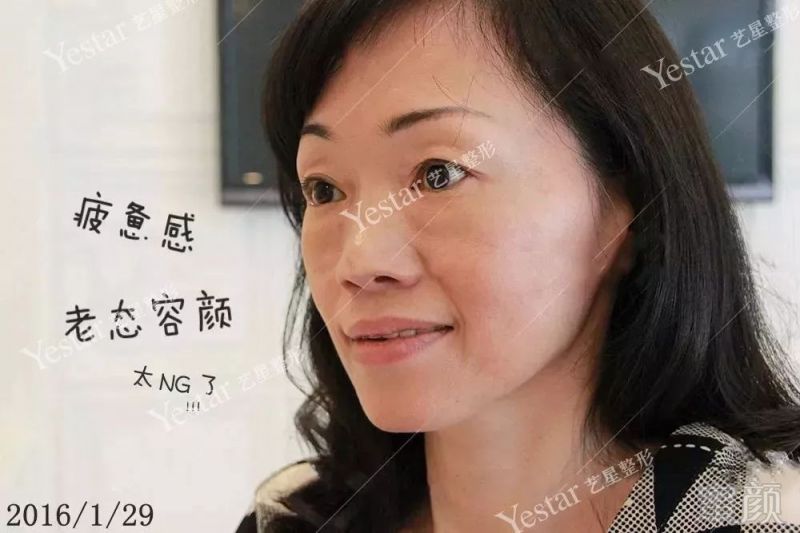 https://img.miyanlife.com/mnt/timg/180218/14512UZ5-0.jpg