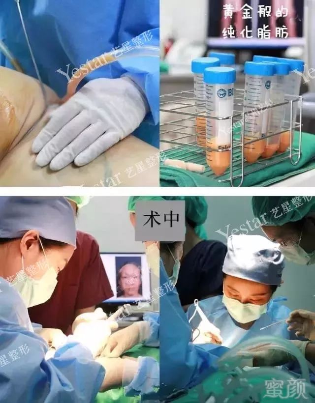 https://img.miyanlife.com/mnt/timg/180218/145130B35-5.jpg