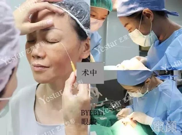 https://img.miyanlife.com/mnt/timg/180218/14513134K-6.jpg