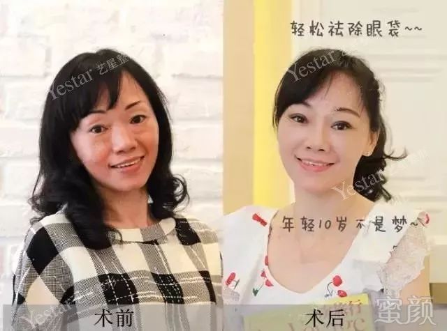 https://img.miyanlife.com/mnt/timg/180218/1451315M8-8.jpg