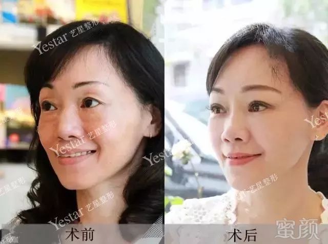 https://img.miyanlife.com/mnt/timg/180218/1451316120-7.jpg