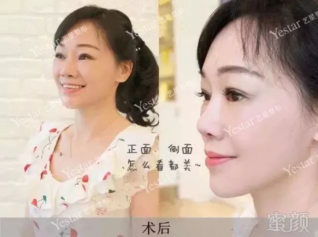 https://img.miyanlife.com/mnt/timg/180218/1451324154-12.jpg
