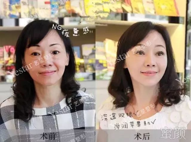 https://img.miyanlife.com/mnt/timg/180218/1451324237-9.jpg