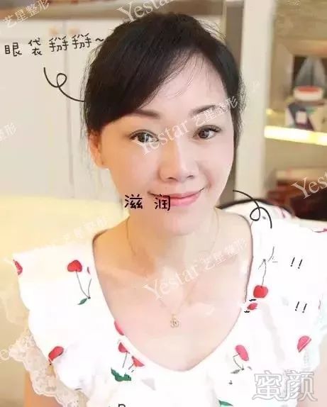 https://img.miyanlife.com/mnt/timg/180218/1451325451-11.jpg