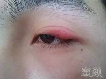https://img.miyanlife.com/mnt/timg/180218/145623C14-1.jpg