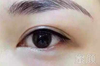 https://img.miyanlife.com/mnt/timg/180218/1456241b8-6.jpg