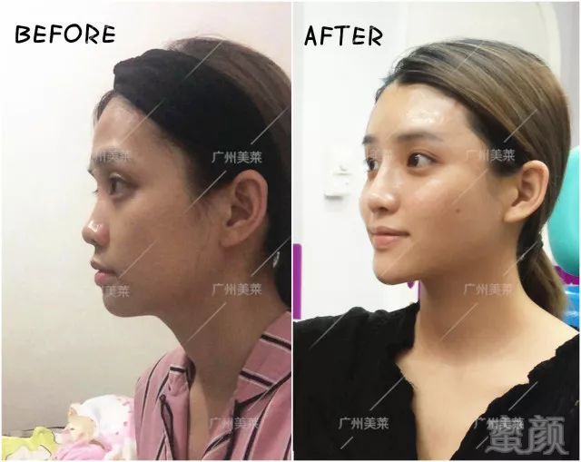 https://img.miyanlife.com/mnt/timg/180218/1515312O6-6.jpg