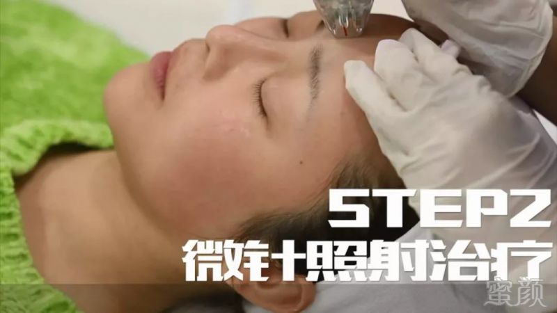 https://img.miyanlife.com/mnt/timg/180219/105125A24-5.jpg