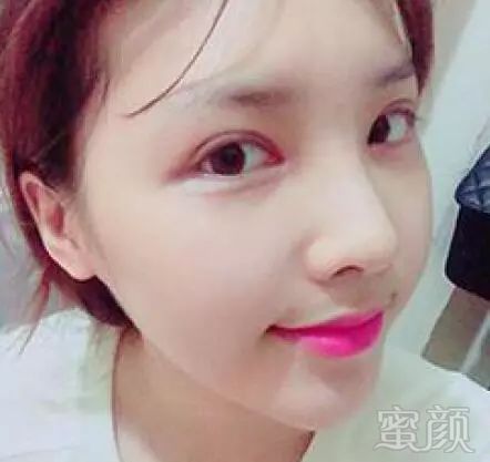 https://img.miyanlife.com/mnt/timg/180219/11095C158-2.jpg