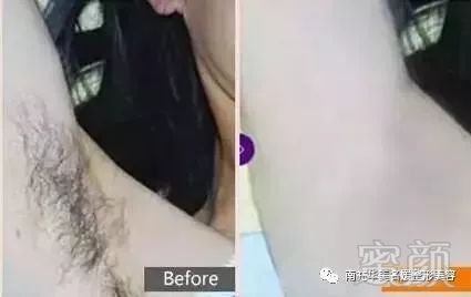 https://img.miyanlife.com/mnt/timg/180220/1133225301-6.jpg