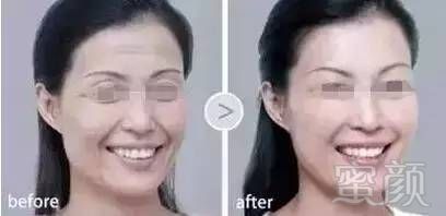 https://img.miyanlife.com/mnt/timg/180220/1146054L0-4.jpg