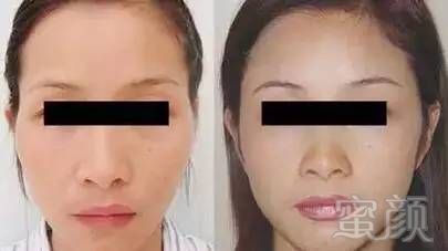 https://img.miyanlife.com/mnt/timg/180220/114605BU-3.jpg