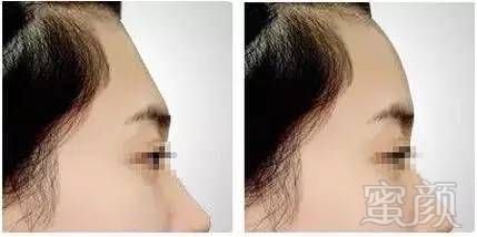 https://img.miyanlife.com/mnt/timg/180220/114605N33-2.jpg