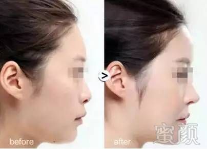 https://img.miyanlife.com/mnt/timg/180220/11460AR1-6.jpg