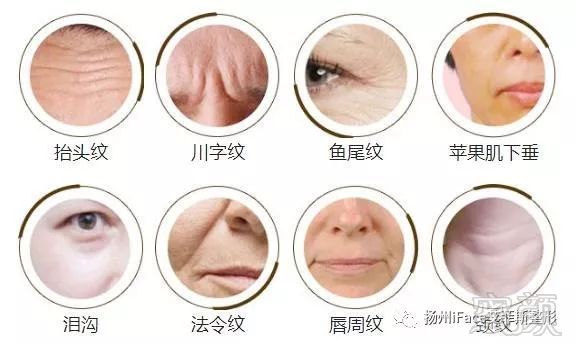 https://img.miyanlife.com/mnt/timg/180220/11545Q4S-8.jpg