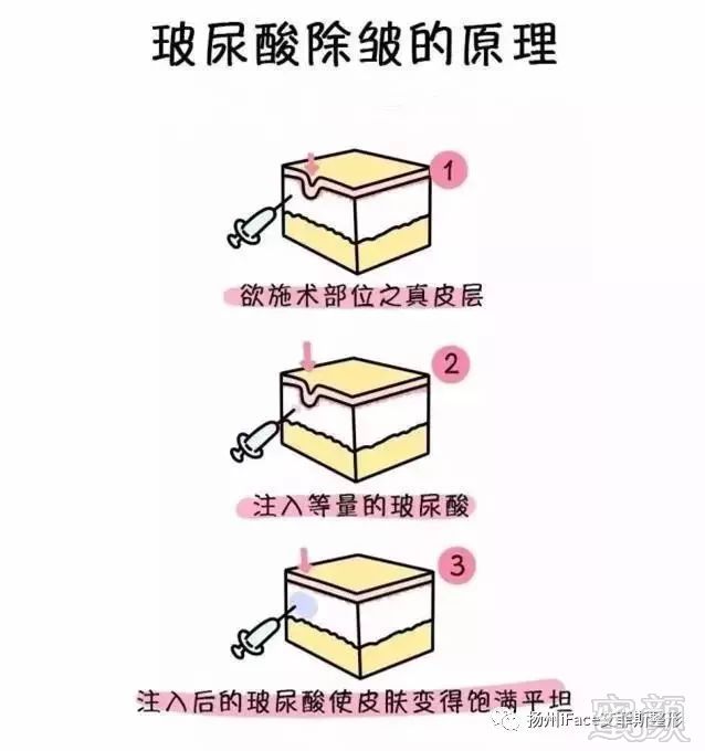 https://img.miyanlife.com/mnt/timg/180220/11545V0L-10.jpg