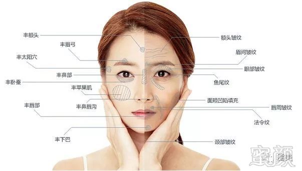 https://img.miyanlife.com/mnt/timg/180221/112ZR153-1.jpg