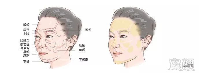https://img.miyanlife.com/mnt/timg/180221/112ZRT0-2.jpg