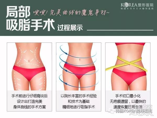 https://img.miyanlife.com/mnt/timg/180221/113212HR-2.jpg