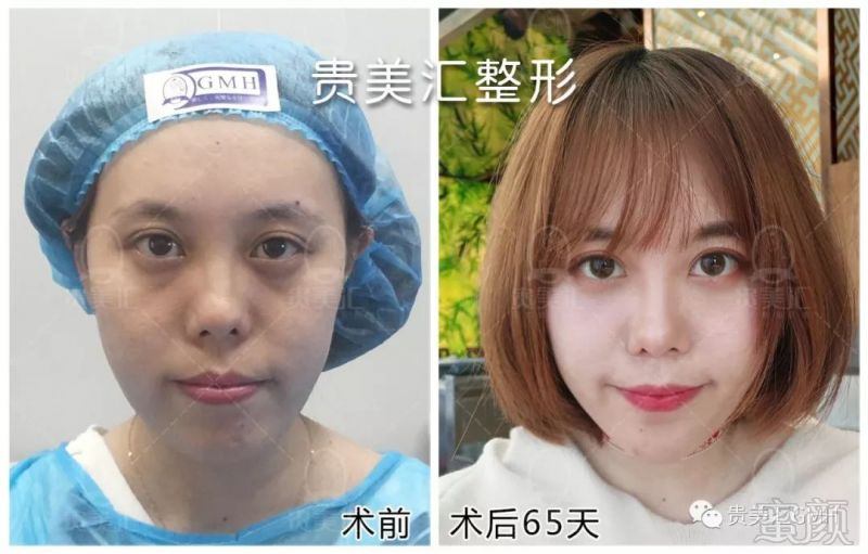 https://img.miyanlife.com/mnt/timg/180221/1133305428-3.jpg