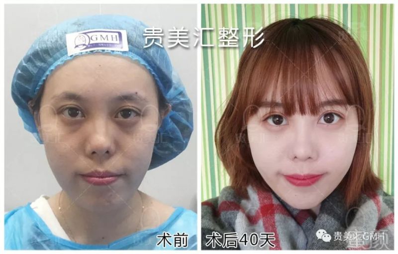 https://img.miyanlife.com/mnt/timg/180221/1133333523-12.jpg